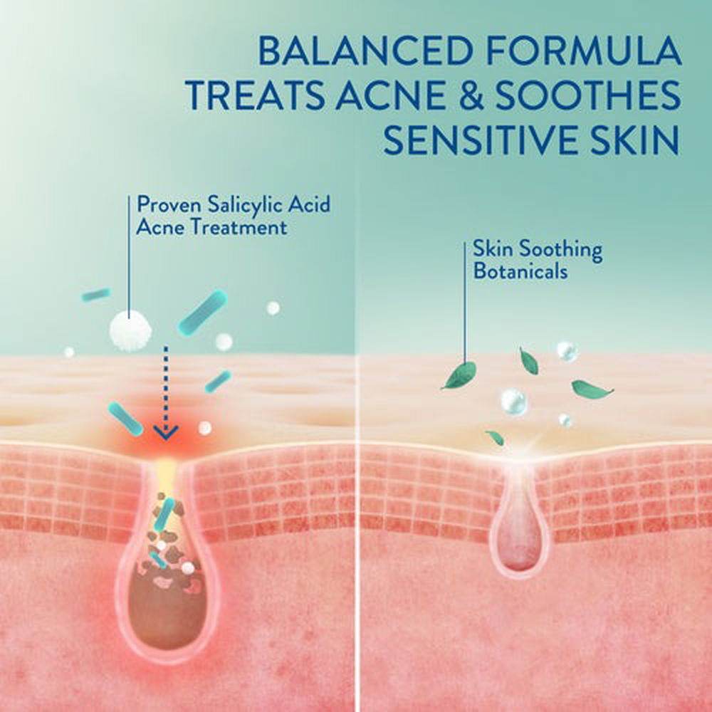 Cetaphil Gentel Clear Mattifying Acne Moisturizer 89Ml - Vitamins House Cetaphil Gentel Clear Mattifying Acne Moisturizer 89Ml - Vitamins House