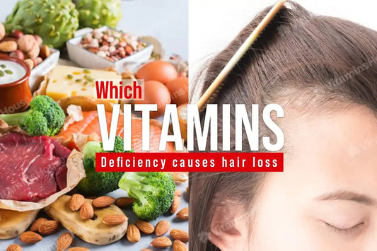 Which Vitamins Deficiency Causes Hair Loss Vitamins House