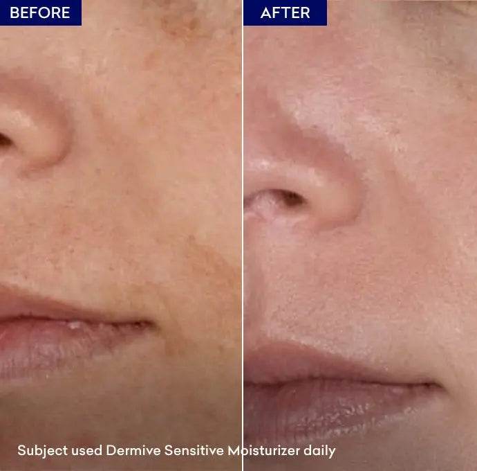 Jenpharm Dermive Sensitive Moisturizer - Vitamins House