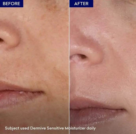 Jenpharm Dermive Sensitive Moisturizer - Vitamins House