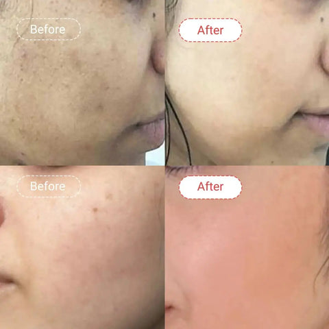 AccuFixCosmetics Kojic Acid Glutathione Skin Brightening Cream