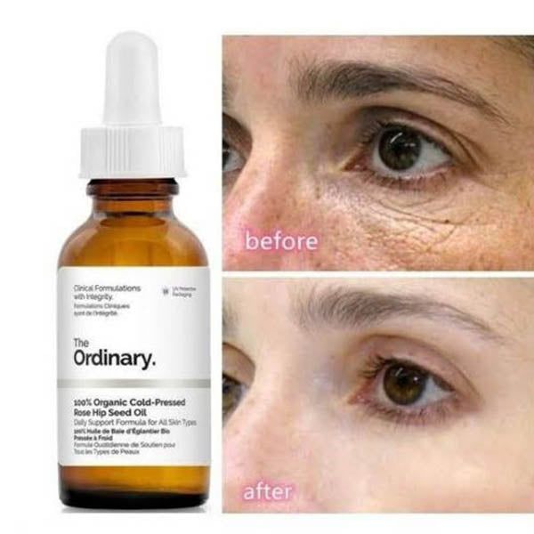 The Ordinary 100% Organic Cold-Pressed Rose Hip Seed Oil - Vitamins House
