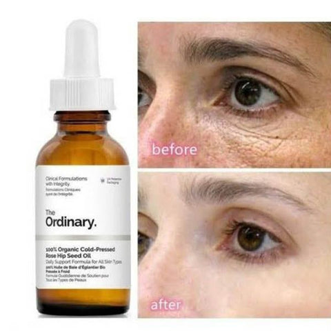 The Ordinary 100% Organic Cold-Pressed Rose Hip Seed Oil - Vitamins House