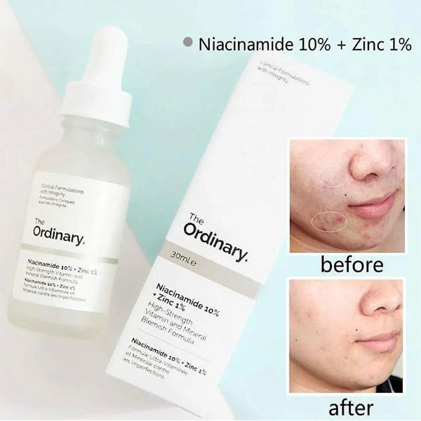 The Ordinary Niacinamide 10% + Zinc 1% 30ml - Vitamins House